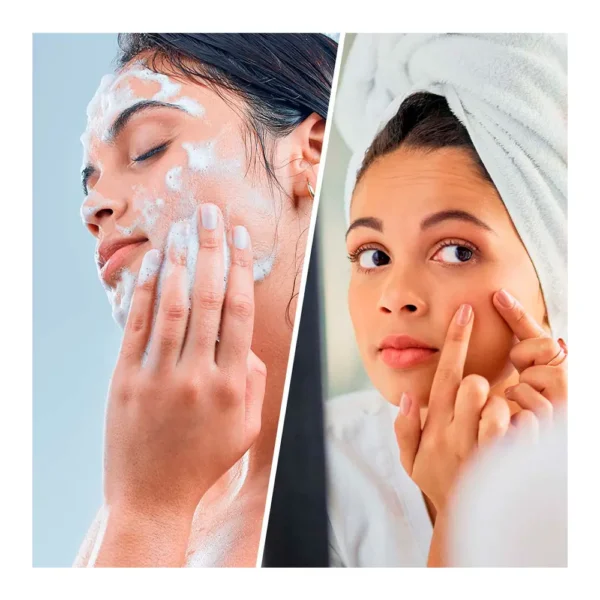 Biovène Salicylic Super Cleanser 200ML for Face & Body - Image 3