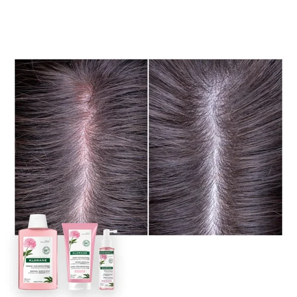 Klorane A La Peony Soothing Conditioner 150ml - Image 4