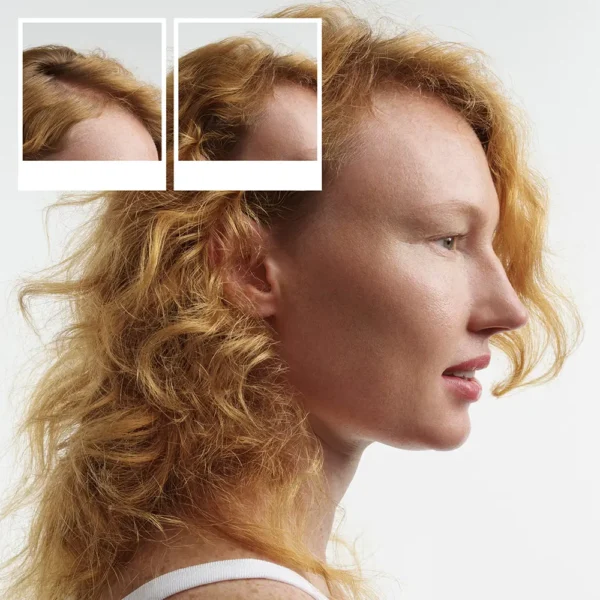 NIOXIN System 1 Treatment Kit for Weak Natural Hair - 3 Units - Image 4