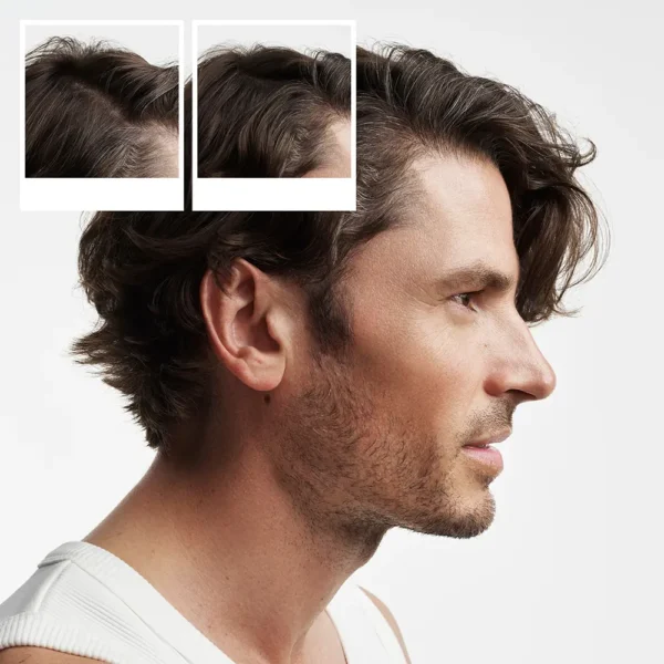 NIOXIN System 2 Natural Hair Treatment Kit – 3 Units - Image 4