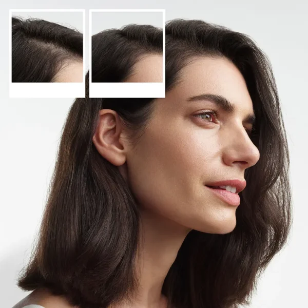 NIOXIN System 3 Treatment Kit for Colored Hair - 3 Units - Image 4