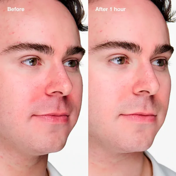 Clinique Anti-Blemish Solutions Gel 20ML - Image 2