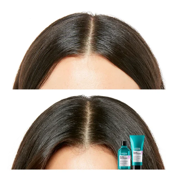 L'ORÉAL PROFESSIONNEL PARIS | SCALP ADVANCED | Shampoos - Image 4