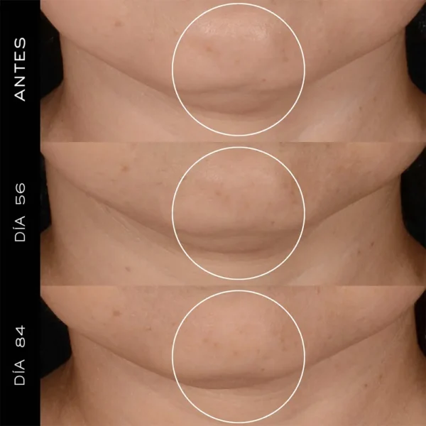 Rénergie HPN Peptide Cream 50ml - Image 3
