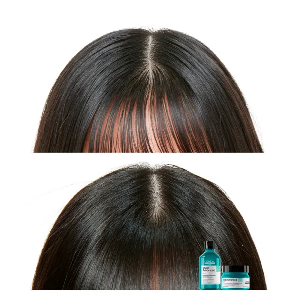 Scalp Advanced 2-In-1 Purifying Shampoo & Mask 250ML - Image 3