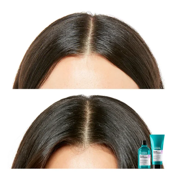 Scalp Advanced Shampoo Refill 500ML - Silicone Free - Image 2